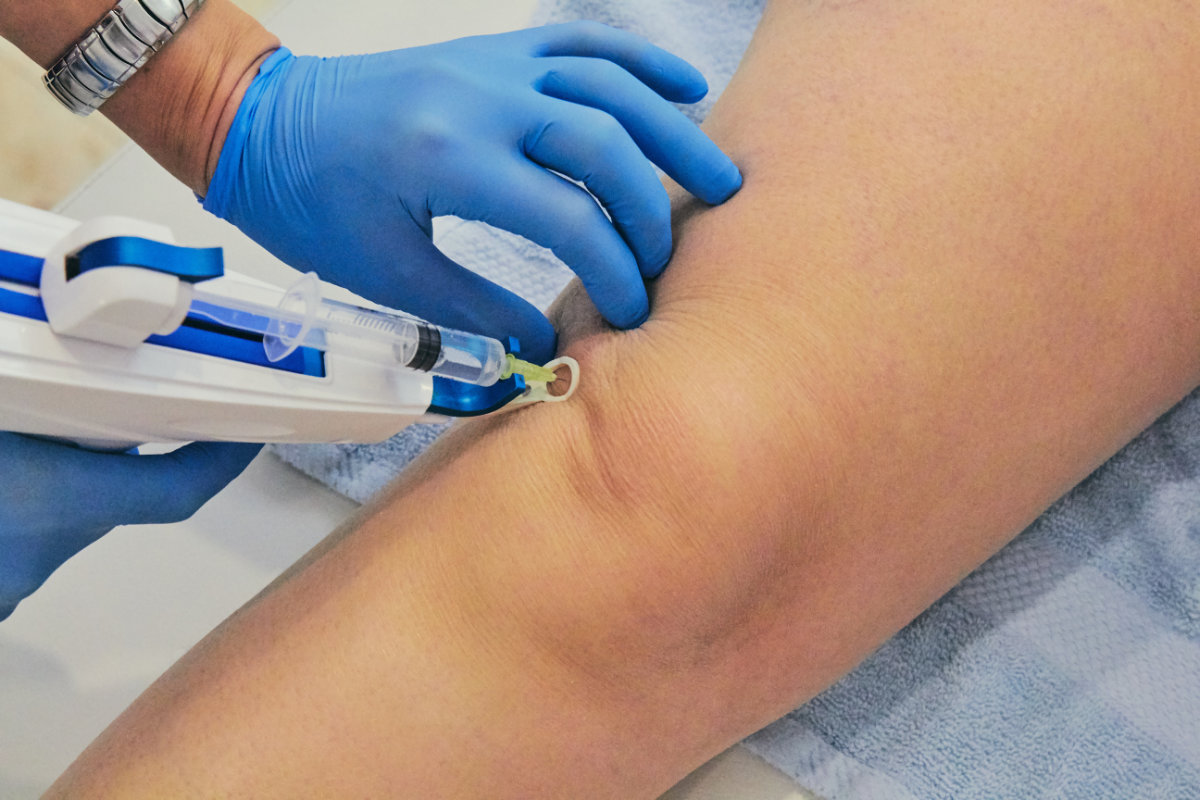 Mesoterapia Antalgica Mesoterapia Antalgica