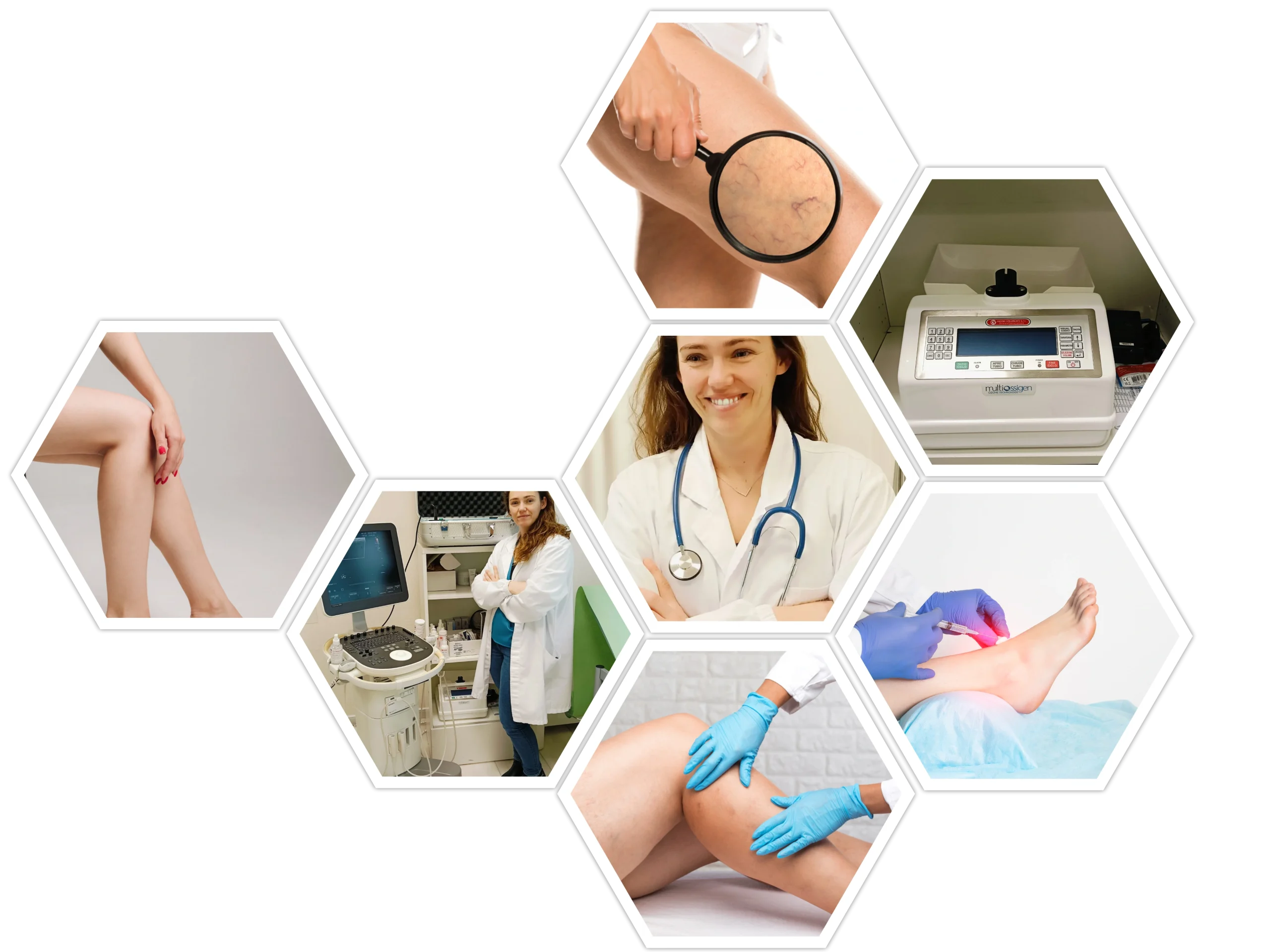 Servizi-Flebologia-Martelli-Costanza-2