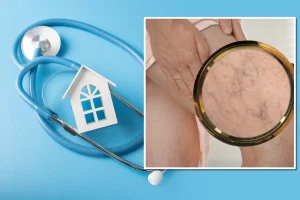 Visita Specialistica Flebologia a domicilio